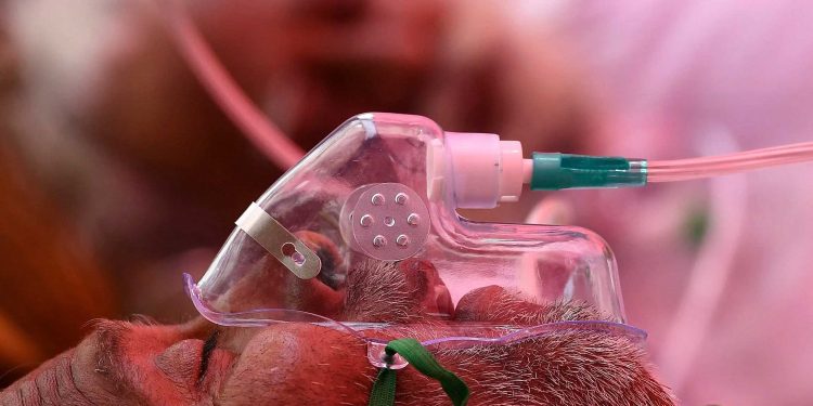 کورونا کے مریضوں میں آکسیجن کی سطح کم کیوں ہو جاتی ہے؟