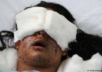 بھارت کشمیر میں بچوں کے خلاف پیلٹ گنوں کا استعمال بند کرے، اقوام متحدہ