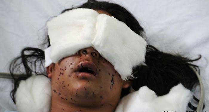 بھارت کشمیر میں بچوں کے خلاف پیلٹ گنوں کا استعمال بند کرے، اقوام متحدہ