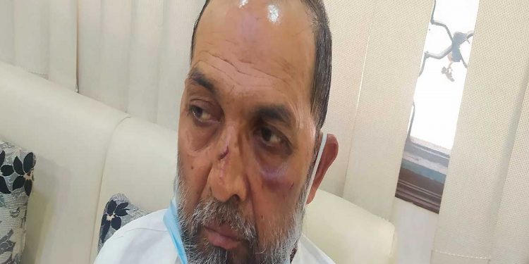 نوئیڈا: کاظم احمد ماب لنچنگ معاملے میں پولیس نے نہیں درج کی ایف آئی آر!
