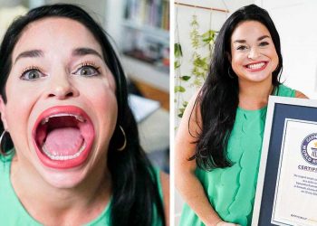 سب سے بڑا منہ رکھنے والی دنیا کی واحد خاتون