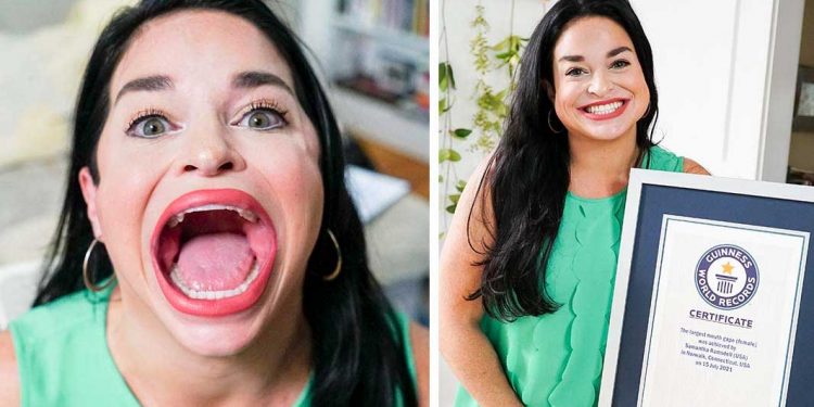 سب سے بڑا منہ رکھنے والی دنیا کی واحد خاتون