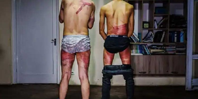 کیا یہ پروپیگنڈہ ہے؟خواتین کا احتجاج کور کرنے پرطالبان نے رپورٹروں کو بے رحمی سے مارا