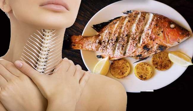 مچھلی کا کانٹا گلے میں اٹک جائے تو پھر کیا کریں؟