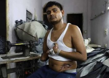 یہ اکرم ہیں ،دہلی فساد میں ایک ہاتھ اور دوسرے کی تین انگلیوں سے محروم ہوگئے تھے