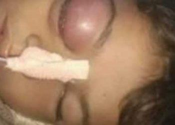 راجستھان: مٹکے سے پانی پینے پر دلت بچے کی پٹائ،موت