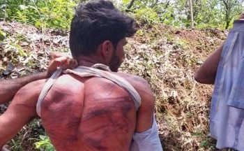 مسلم اسٹوڈنٹ کی لاٹھیوں سے پٹائ،ہندو ساتھی لڑکی سے بات کرنے کی ‘سزا’