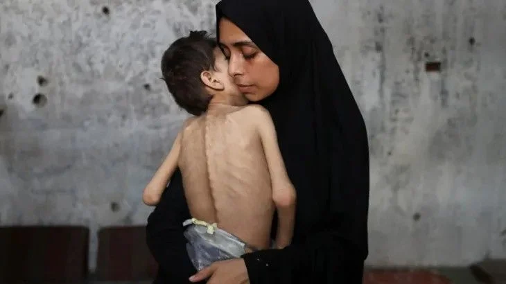 فاقہ زدہ غزہ:غذائی قلت سے 188بچے فوت,آخر ٹرمپ نے بھی مان لیا کہ&nbsp; ——